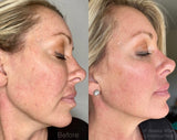 before and after of mature skin with age defy, anti aging face oil skincare
