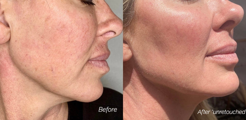 before and after of mature skin with age defy, anti aging face oil skincare